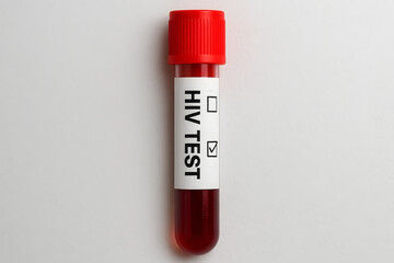 Blood test tube labeled "HIV TEST" with a red cap against a white background