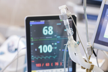 Ventilator tubing with patient monitor in modern hospital surgery unit