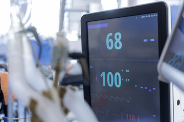 Patient monitor showing vital signs in modern hospital ICU