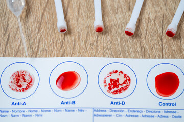 Blood typing test card with Anti-A, Anti-B, Anti-D result, diagnostics and health awareness, personal health and awareness, self-care monitoring, self-testing for diet, agglutination process © kittyfly