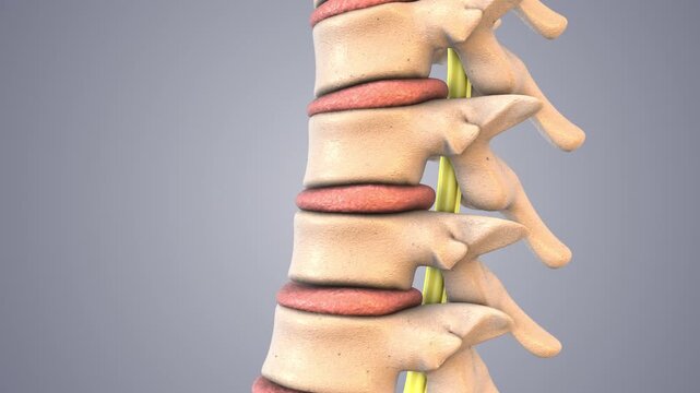 Spinal Decompression Therapy Explained in Medical Animation
