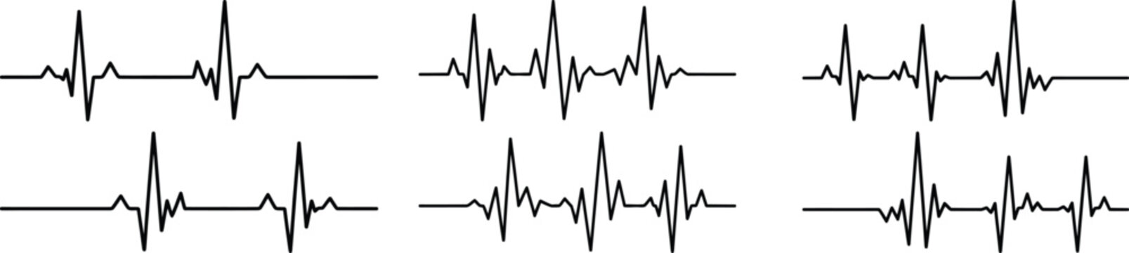 Six distinct electrocardiogram waveforms displayed against a white background