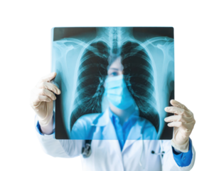 A healthcare professional holds an X-ray image of lungs, demonstrating a focus on medical imaging and respiratory health.