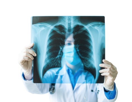 A healthcare professional holds an X-ray image of lungs, demonstrating a focus on medical imaging and respiratory health.