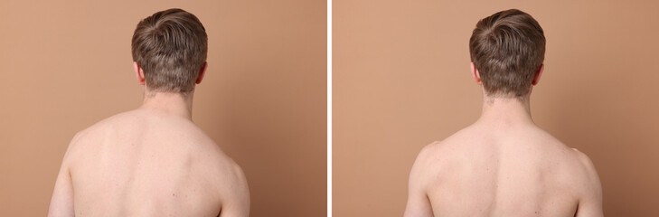 Naklejka premium Before and after collage showing man with good and bad posture against pale brown background