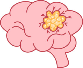 Brain Cancer, Stroke disease. Hemorrhagic brain stroke concept. Apoplexy, Brain Tumor