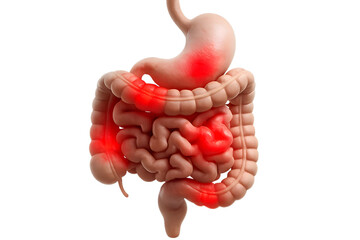 Medical Illustration of Human Digestive System with Inflammation and Pain Redness
