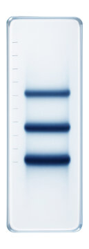 Distinct pattern of three closely spaced bands in a gel lane