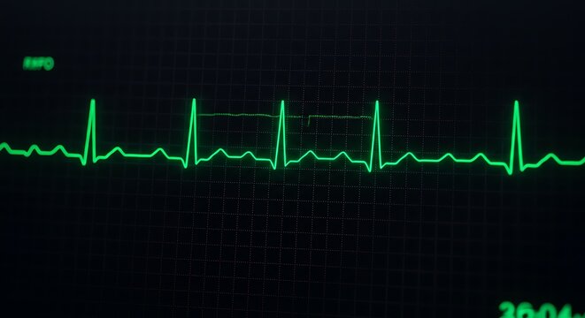 Electrocardiogram Heart Rate Monitor Display with Green Line on Dark Background