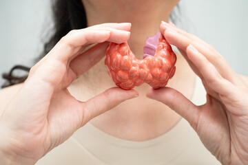 Hyperthyroidism, Overactive Thyroid, Thyroid Lymphoma, Asian woman with thyroid gland human anatomy...