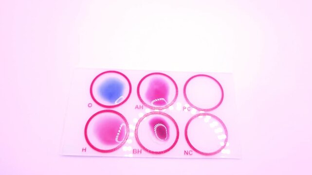 Widal test by agglutination method at plate isolated on white background, to diagnosis Typhoid and Paratyphoid fever at laboratory, Closeup microbiology research in laboratory.