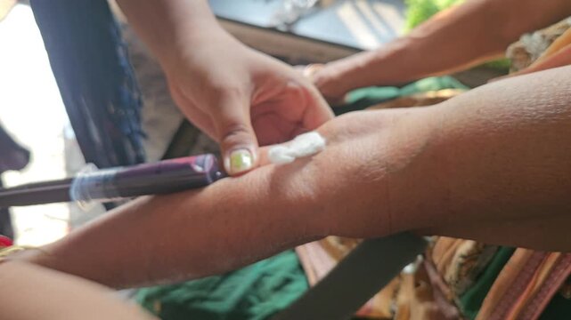 Medical professional performing a venipuncture, commonly known as drawing blood or a blood draw, from a patient's arm using a syringe and needle. This procedure is routinely done for various purposes
