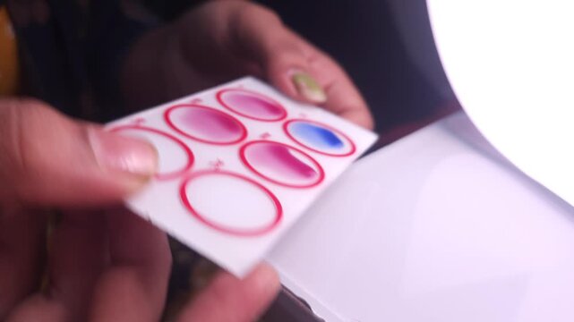 Widal test by agglutination method at plate isolated on white background, to diagnosis Typhoid and Paratyphoid fever at laboratory, Closeup microbiology research in laboratory. India