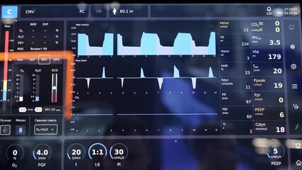 Medical ventilator screen showing patient's respiratory parameters. Media - Powered by Adobe