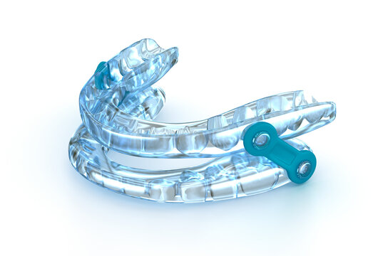 Oral appliance therapy device, sleep apnea treatment. 3D illustration