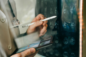Doctor examining X-ray images with a digital tablet in a clinical setting