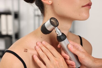 Doctor examining young woman's mole with dermatoscope in hospital, closeup