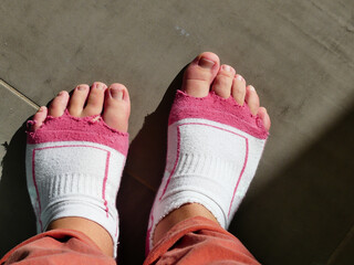 pied bot plus court  , la malformation est masquée par les chaussettes originales 