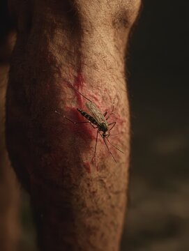 realistic closeup of a swollen human leg with visible mosquito bite and surrounding redness symbolizing insectrelated health risks and summer skin irritation