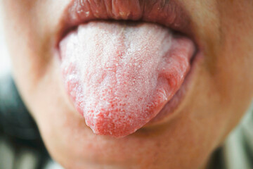 Close up image of person sticking out their tongue, showing texture and detail. focus is on mouth and tongue, highlighting natural surface and color