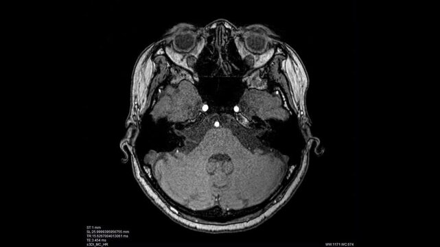 brain scan mri or brain x-ray images by ct scan or mri scanner.	above view.