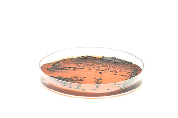 Bacterial culture plate in the Microbiology laboratory. Infection and immune system.