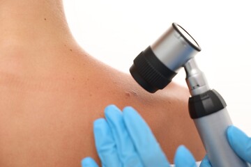 Doctor examining young woman's mole with dermatoscope on white background, closeup