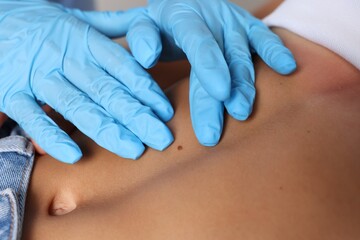 Doctor examining young woman's mole in hospital, closeup