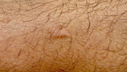 close up of human skin with natural hair and small bump texture for medical background or...