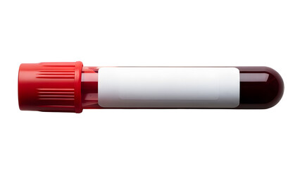 Blood test tube sample medical laboratory analysis healthcare diagnosis bloodwork science research 100 on transparent background