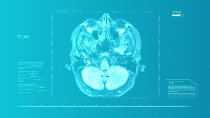 Medical Scan: Brain MRI with Data Overlay and Power Indicator - Powered by Adobe