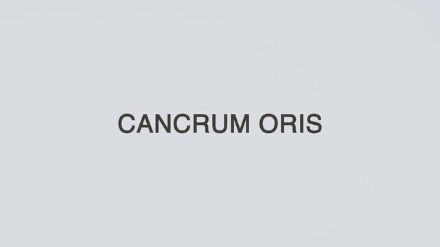 Cancrum oris word diagnosed with a stethoscope held in hand on a clean white background, symbolizing severe infection, medical diagnosis, healthcare concept, and awareness