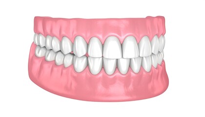 Fototapeta premium 3D model of human teeth and gums