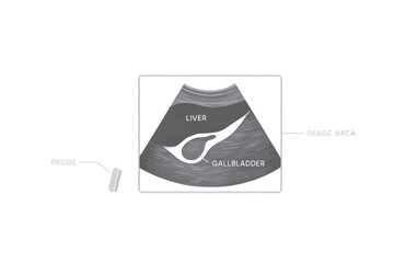 Vector ultrasound scan image highlighting liver and gallbladder anatomy with contrast shape, used in diagnostic and educational visuals.