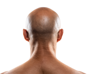 Bald man showing the back of his head with smooth skin texture on a transparent background, cut out
