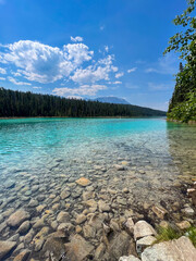 The turquoise waters and rocky bottom of the First Lake, Valley of the Five Lakes, Jasper NP, Canada