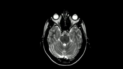 MRI brain scan magnetic resonance imaging top Neurology data analysis process Diagnosis of disease - Powered by Adobe