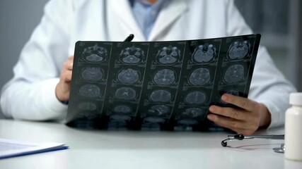 Senior doctor examining a tomographic brain scan. Doctor examining X-ray, Magnetic resonance image of head. medical research Health Care Neurologist.