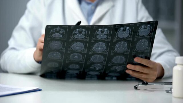 Senior doctor examining a tomographic brain scan. Doctor examining X-ray, Magnetic resonance image of head. medical research Health Care Neurologist.