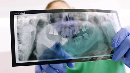 Dental X ray of jaw with teeth. X-ray radiography of teeth. Doctor examining scan of patient teeth for damage and disease. Doctor examining teeth x ray image.