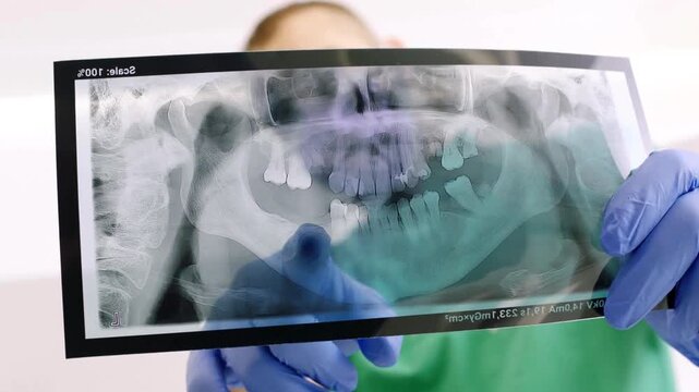 Dental X ray of jaw with teeth. X-ray radiography of teeth. Doctor examining scan of patient teeth for damage and disease. Doctor examining teeth x ray image.