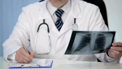 unrecognizable doctor examining patient chest x-ray film lungs scan at radiology department in hospital. doctor checking x-rays to examine patient disease. - Powered by Adobe