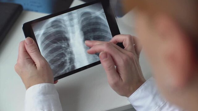 doctor medical checking x-ray image of patient's lungs on digital tablet screen in hospital. radiologist analyzing CT scan of patient lungs in hospital office.