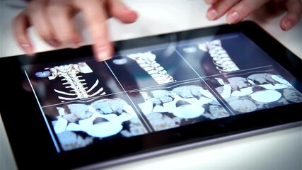 Orthopedic analyzing X-ray image of patient's spine on digital tablet. Physician in white coat sitting at desk and pointing out at spine x-ray on screen. - Powered by Adobe