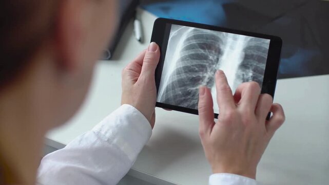 doctor medical checking x-ray image of patient's lungs on digital tablet screen in hospital. radiologist analyzing CT scan of patient lungs in hospital office.