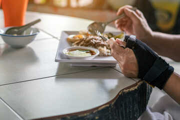 Hands of woman with thumb spica finger splint uses spoon and fork  to eat. Woman uses wrist support brace and have a meal. Hand in cast. female hands with orthosis. Injured hand of woman eating food.