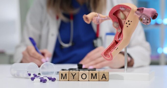 Doctor writes at desk with Myoma on blocks and reproductive system model. Fibroids highlight medical awareness diagnosis and treatment in hospital