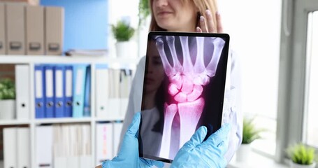 Doctor holds tablet showing X-ray scan against woman raising broken arm in cast. Specialist explains fracture helping to understand injury in clinic - Powered by Adobe
