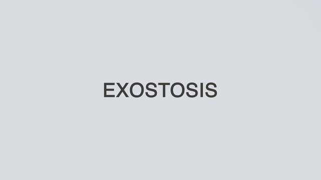 Exostosis word diagnosed with a stethoscope held in hand on a white background, illustrating bone growth disorder, medical evaluation, healthcare concept, and patient awareness