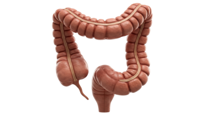 Isolated Colon